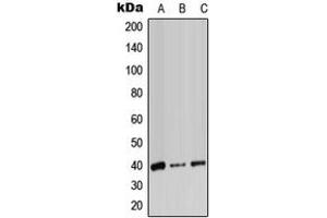 Western blot analysis of ADH7 expression in HeLa (A), SP2/0 (B), PC12 (C) whole cell lysates. (ADH7 anticorps  (Center))