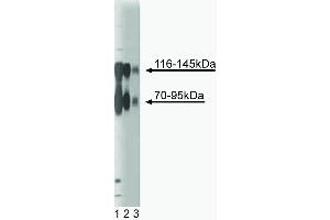 Western blot analysis of TrkB on a rat cerebrum lysate (left).