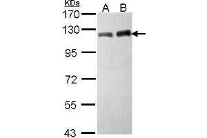 WB Image Sample (30 ug of whole cell lysate) A: Hela B: Hep G2 , 7. (KAP1 anticorps  (N-Term))
