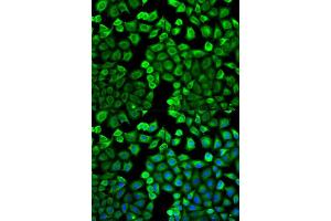 Immunofluorescence analysis of U2OS cell using HNMT antibody.
