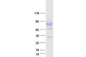 Validation with Western Blot