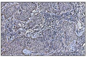 IHC analysis of JAB1 using anti-JAB1 antibody (ABIN7602482). (COPS5 anticorps  (AA 8-334))