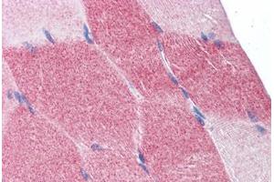 Human Skeletal Muscle: Formalin-Fixed, Paraffin-Embedded (FFPE) (EIF4G2 anticorps  (AA 1-204))