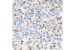 Immunohistochemistry of paraffin-embedded rat ovary using PBRM1 Rabbit mAb (ABIN1512585, ABIN3020942, ABIN3020943 and ABIN7101308) at dilution of 1:100 (40x lens). (Polybromo 1 anticorps)