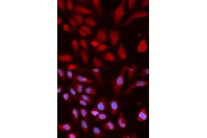 Immunofluorescence analysis of U2OS cells using UHRF1 antibody.