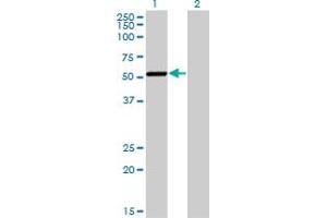 Western Blot analysis of CAMK1G expression in transfected 293T cell line by CAMK1G monoclonal antibody (M01), clone 3E2.