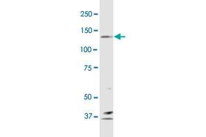 PCDH10 monoclonal antibody (M01), clone 4H8.