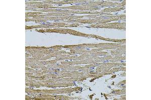 Immunohistochemistry of paraffin-embedded rat heart using HMMR antibody (ABIN5971368) at dilution of 1/100 (40x lens). (HMMR anticorps)