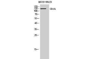 Western Blotting (WB) image for anti-CD101 (CD101) (Internal Region) antibody (ABIN3178946) (CD101 anticorps  (Internal Region))