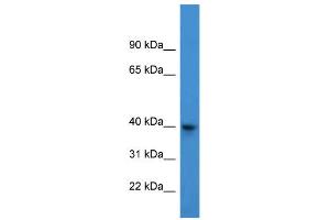 WB Suggested Anti-ARPM1 Antibody Titration: 0. (ARPM1 anticorps  (N-Term))