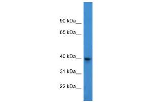 WB Suggested Anti-ARPM1 Antibody Titration: 0. (ARPM1 anticorps  (N-Term))