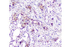 IHC analysis of ADA using anti-ADA antibody (ABIN6719272). (ADA anticorps  (AA 135-363))