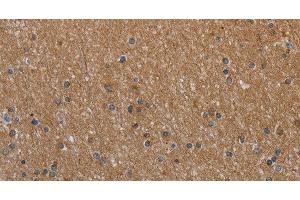 Immunohistochemistry of paraffin-embedded Human brain tissue using NAA25 Polyclonal Antibody at dilution 1:40 (NAA25 anticorps)
