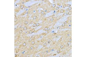 Immunohistochemistry of paraffin-embedded mouse brain using HSP90 antibody (ABIN6134707, ABIN6142027, ABIN6142029 and ABIN6216078) at dilution of 1:200 (40x lens). (HSP90AA1 anticorps)