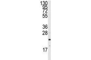 Western blot analysis of NRAS antibody and CEM lysate.