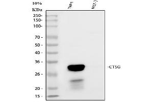 Western blot analysis of Cathepsin G/CTSG using anti-Cathepsin G/CTSG antibody (ABIN4886550). (Cathepsin G anticorps  (AA 25-252))