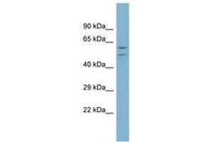 Image no. 1 for anti-ATPase, H+ Transporting, Lysosomal 56/58kDa, V1 Subunit B1 (ATP6V1B1) (AA 395-444) antibody (ABIN6744044) (ATP6V1B1 anticorps  (AA 395-444))