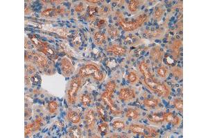 IHC-P analysis of kidney tissue, with DAB staining. (Lactate Dehydrogenase A anticorps  (AA 1-332))