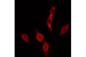ABIN6276046 staining MCF7 by IF/ICC. (MC4R anticorps  (C-Term))