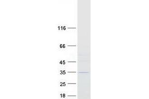 Validation with Western Blot