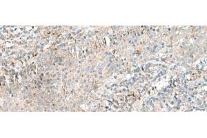 Immunohistochemistry of paraffin-embedded Human tonsil tissue using CTRB1 Polyclonal Antibody at dilution of 1:55(x200)