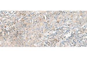 Immunohistochemistry of paraffin-embedded Human tonsil tissue using CTRB1 Polyclonal Antibody at dilution of 1:55(x200) (CTRB1 anticorps)