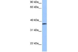 WB Suggested Anti-UBA5 Antibody Titration:  0. (UBA5 anticorps  (Middle Region))