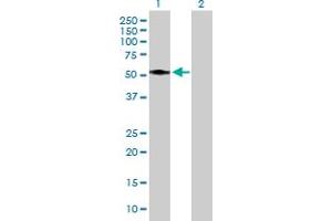Western Blot analysis of ASAH1 expression in transfected 293T cell line by ASAH1 MaxPab polyclonal antibody.