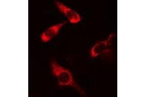ABIN6277817 staining COLO205 cells by IF/ICC. (CARD11 anticorps  (Internal Region))