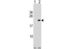 Western Blotting (WB) image for anti-phospholipase A2, Group XIIA (PLA2G12A) antibody (ABIN2998884)