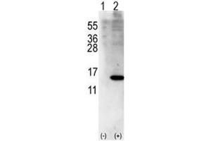 Western blot analysis of ISG15 antibody and 293 cell lysate (2 ug/lane) either nontransfected (Lane 1) or transiently transfected with ISG15 gene (2).