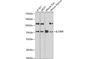 Western blot analysis of extracts of various cell lines, using IL12RB1 antibody (ABIN6132305, ABIN6142300, ABIN6142302 and ABIN6219020) at 1:1000 dilution. (IL12RB1 anticorps  (AA 25-305))