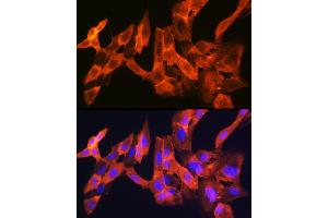 Immunofluorescence analysis of C6 cells using JNK1/JNK3 Rabbit mAb (ABIN1678909, ABIN7101754, ABIN7101755 and ABIN7101756) at dilution of 1:100 (40x lens). (JNK anticorps)