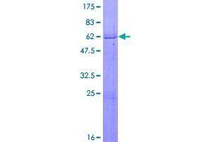 Image no. 1 for Zinc Finger Protein 365 (ZNF365) (AA 1-276) protein (GST tag) (ABIN1326141)