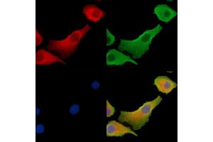 ABIN7095402 and ABIN7099459 staining Hela cells by IF/ICC.