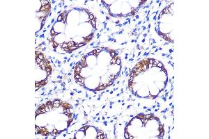 Immunohistochemistry of paraffin-embedded rat testis using Serotonin transporter Rabbit pAb (ABIN7270477) at dilution of 1:100 (40x lens). (SLC6A4 anticorps  (C-Term))