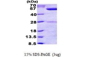 PhrB (AA 1-472) protein (His tag)