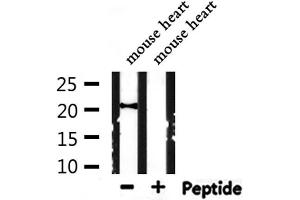 Western blot analysis of extracts from mouse heart, using ARF6 Antibody. (ARF6 anticorps  (Internal Region))