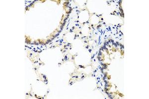Immunohistochemistry of paraffin-embedded rat lung using IFNL1 antibody at dilution of 1:100 (40x lens). (IL29 anticorps)