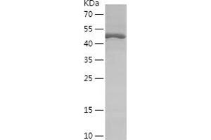 Western Blotting (WB) image for Ribosomal Protein S6 Kinase, 70kDa, Polypeptide 1 (RPS6KB1) (AA 51-300) protein (His-IF2DI Tag) (ABIN7124903)