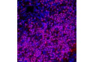 Immunofluorescence of paraffin embedded rat thymus using TCF7 (ABIN7075952) at dilution of 1:600 (400x lens) (TCF7 anticorps)