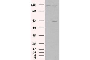 Western Blotting (WB) image for Monoamine Oxidase A (MAOA) peptide (ABIN368822)