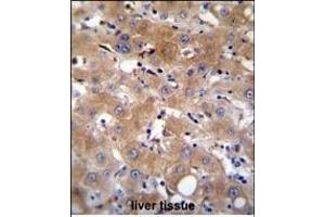 TR Antibody (Center) (ABIN655714 and ABIN2845164) immunohistochemistry analysis in formalin fixed and paraffin embedded human liver tissue followed by peroxidase conjugation of the secondary antibody and DAB staining. (TRPM8 anticorps  (AA 263-292))