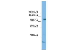 WB Suggested Anti-SMEK1 Antibody Titration: 0. (SMEK1 anticorps  (Middle Region))