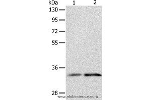 Western blot analysis of Human fetal kidney and intestine tissue, using IL1RL1 Polyclonal Antibody at dilution of 1:1100 (IL1RL1 anticorps)