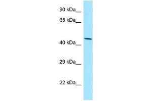 WB Suggested Anti-MMP28 Antibody Titration: 1. (MMP28 anticorps  (C-Term))