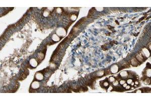 ABIN6267436 at 1/100 staining Mouse intestine tissue by IHC-P. (CBL anticorps  (pTyr674))