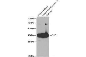 Western blot analysis of extracts of various cell lines using GPD1 Polyclonal Antibody at dilution of 1:1000. (GPD1 anticorps)