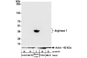 Western Blotting (WB) image for anti-Arginase, Liver (ARG1) (AA 1-322) antibody (ABIN7453894)