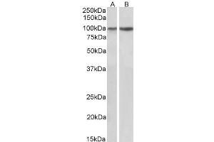 ABIN5539639 (1µg/ml) staining of Human (A) and Mouse (B) Heart lysates (35µg protein in RIPA buffer). (ITGA3 anticorps  (C-Term))